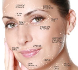 Advanced-Botox-Treatment-Areas-Platinum-Aesthetics